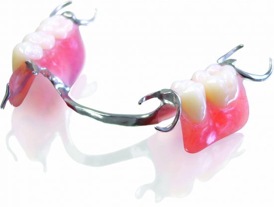 Chrome Cobalt Partial Dentures